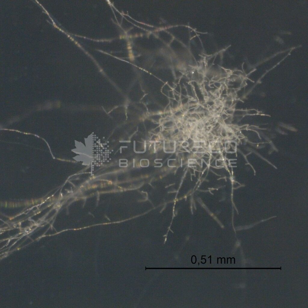 NoFly-Spore-Microscope